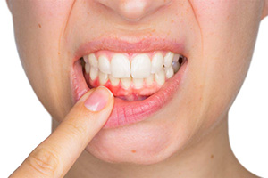 dental services periodontal-care